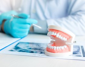 Dentist in blue gloves examining patient’s x-rays at a desk with artificial teeth