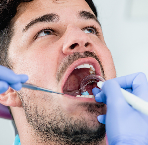 Man getting a dental cleaning
