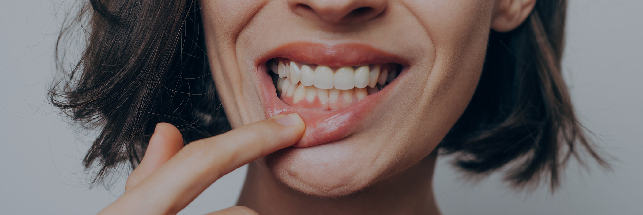 Woman pointing to her gums