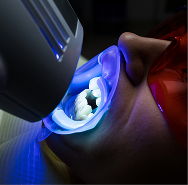Dental patient getting in-office teeth whitening
